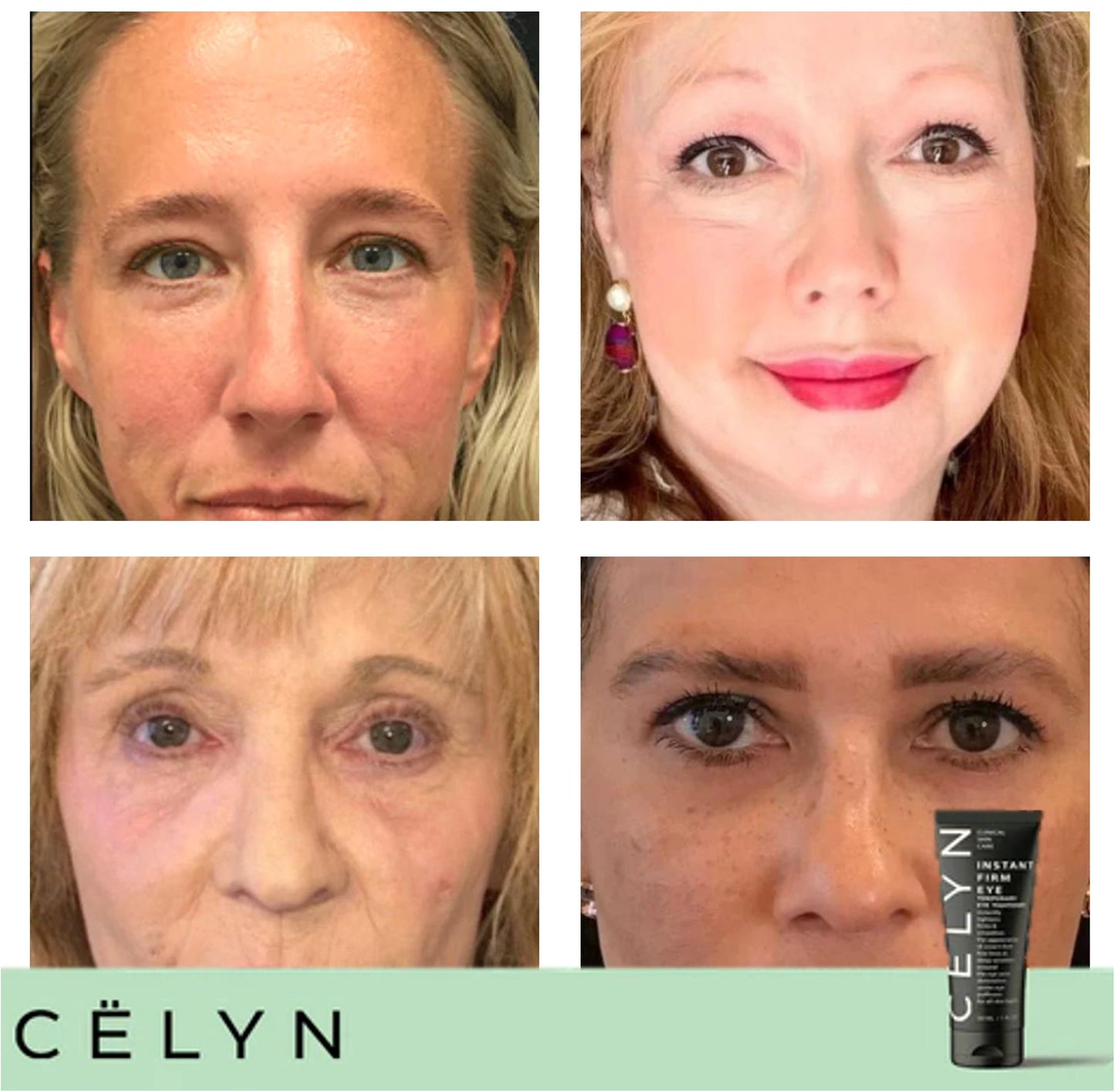 CËLYN CREAM™ | Anti wallen créme | 1+1 Gratis!