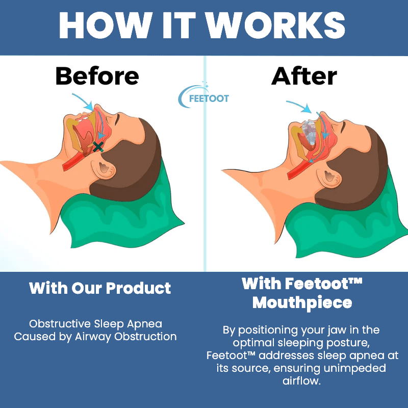 QuietNite™ Elite | Anti Snurken Mondstuk™